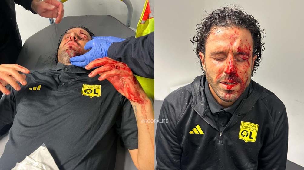 الشغب يتسبب في تأجيل مباراة ليون و مارسيليا الفرنسيان