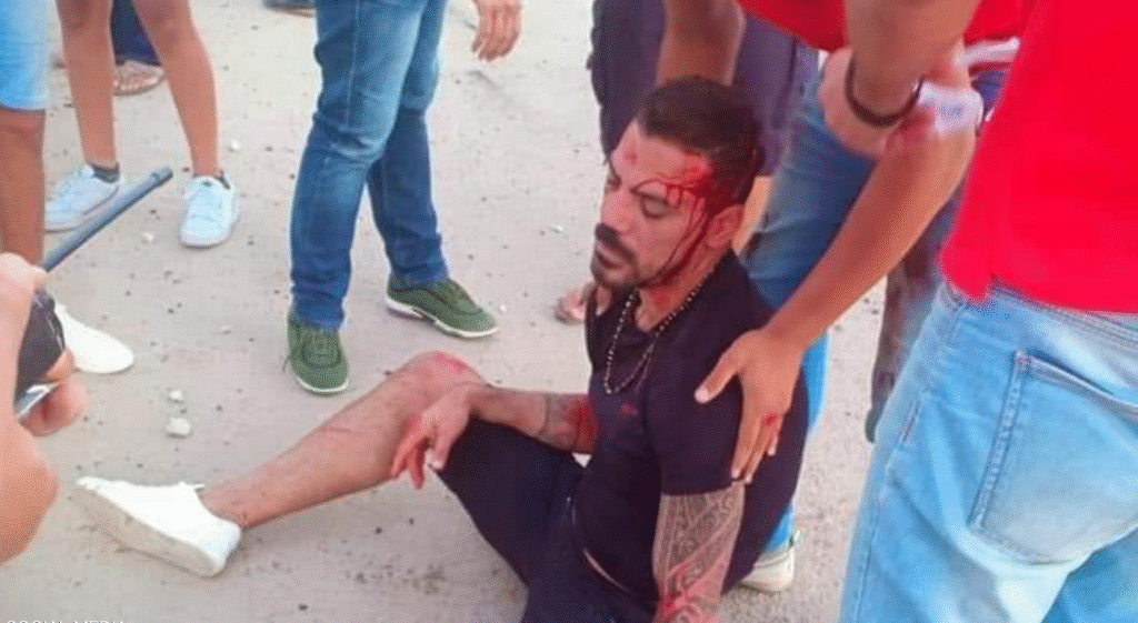 شرخ في الصدر وغرز بالرأس .. تعرف على الحادث المروع لنجم الكرة المصرية